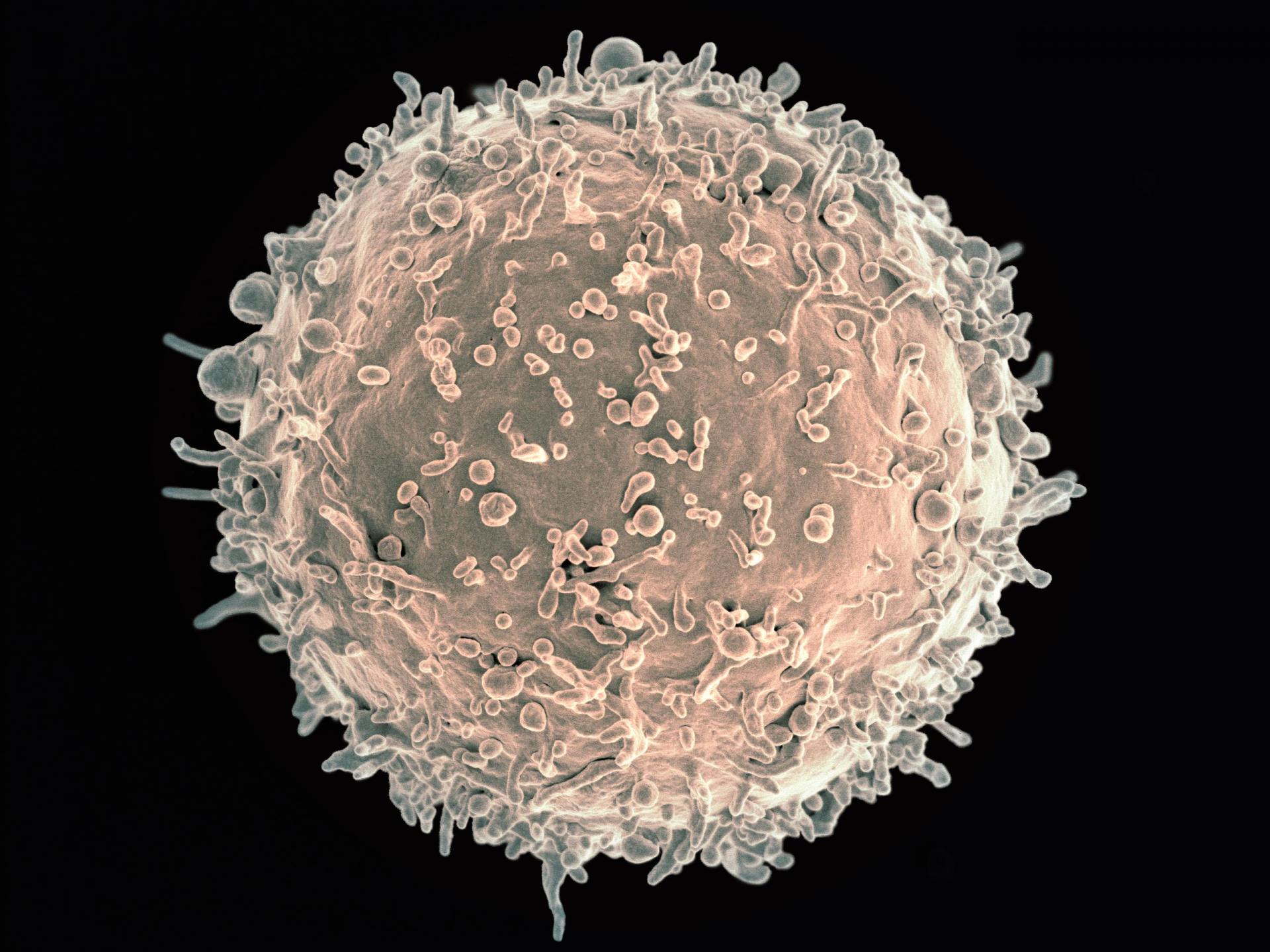Human b lymphocyte